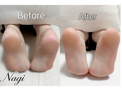 ナギネイル(Nagi Nail)の写真