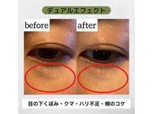 アクティブエイジング/【エンビロン】オトナ目元