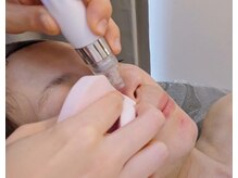 シス(SiS)/ハイドラピーリング