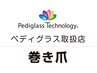 【巻き爪/深爪/厚爪】巻き爪相談無料 ￥0