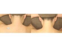 エステアンドヘアーサロン アルテ 札幌