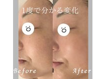 レア(Lea)の雰囲気（再生フェイシャルで美肌リフトアップ！）