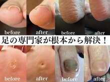 ドクターネイル爪革命 札幌本店