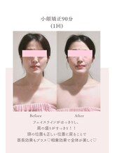 トゥインクル 麻布(twinkle)/港区/ブライダルエステ/小顔矯正