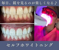 グリッター ショウナン(glitter.SHONAN)