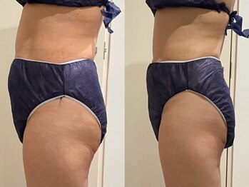 キララ(Kirara)/疲労回復 × ボディメイク