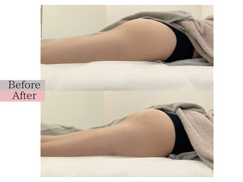 フロリール アザブジュウバン(FlorirAzabujuban)/痩身/美脚/ブライダル