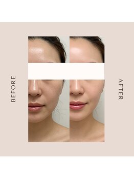 ドゥシュール(Douceur)/インディバ×エンビロン