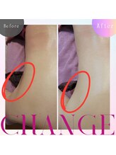 ハウオリ(Hauoli)/猫背気味のあなた