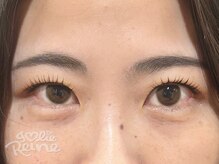 ジョリレーヌ(Jolie Reine)/