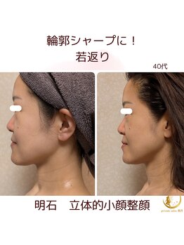 プライベートサロン 美月/立体的小顔