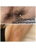 男性【脇ダブル】WAX+光脱毛★ その場でツルツル♪