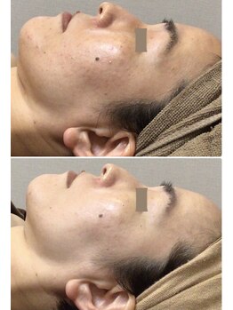 クレビア(CREBIA)/