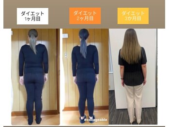サロン誠流の写真/たった3ヶ月で-18kg以上減。脂肪だけじゃない。歪み・むくみから整えて細くする太もも・ヒップケア