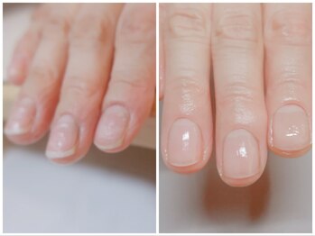アヤネイル(Aya nail)/自爪育成ケア