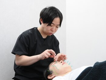 フロー鍼灸整体院(FLOW鍼灸整体院)の写真/初めて美容鍼を受けられる方におすすめ◎むくみ・たるみ・左右差を根本ケア！