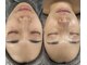 サラ 神楽坂(Sara)の写真/毛穴だけで終わらない。40代から始める肌質改善で、自信の持てる素肌へ♪
