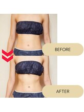 フロレゾン(Floraison)/スリムキャビ