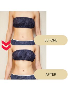 フロレゾン(Floraison)/スリムキャビ