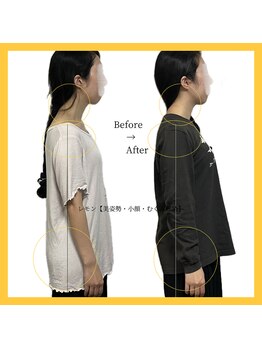 美容整体 レモン/ブライダル整体