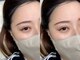 チュチュアチュチュ(chuchu a chuchu)の写真/［まつ毛パーマ］かわいい愛されeyeが叶う♪カールのモチ×design力が話題♪【初回/ブラックティント無料】