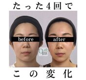 キュープ 名張店(Qpu)