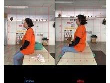 ストレチックス 近江八幡店/BeforeAfter