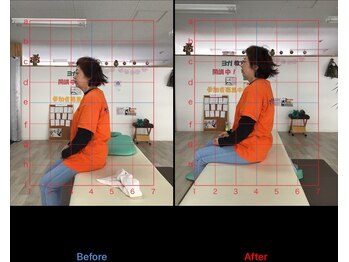 ストレチックス 近江八幡店/BeforeAfter