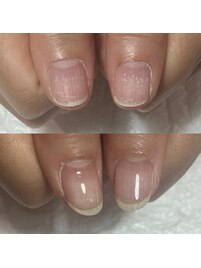 傷み爪も健康的な爪に育む
