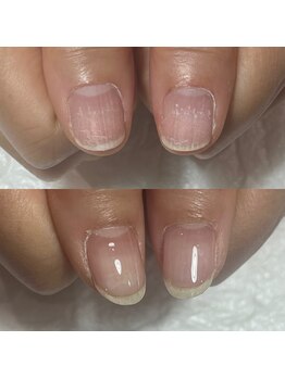 キュア(Cure.)/傷み爪も健康的な爪に育む