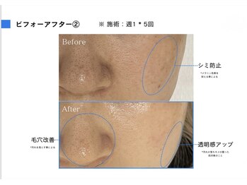 アリミリサロン(A.Rimi.Ri salon)/セラピール