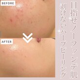 サロンアールミヨン(Salon R Miyon)