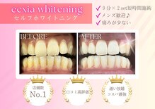 エクシアホワイトニング 碧南店