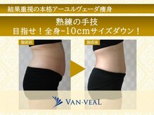 ヴァン ベール 光の森店