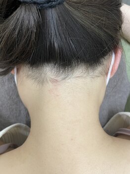 ナノハナ/鹿沼市の全身脱毛のナノハナ