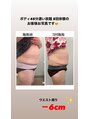 ヴィーナス(Venus) 1回の施術でもウエスト周りー1.3センチ 太もも周りー1センチ
