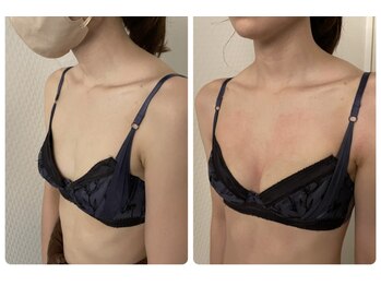 プレフィール(PLEAFEEL)/