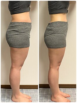 リンド(Lindo)/筋膜リリース☆ブライダル