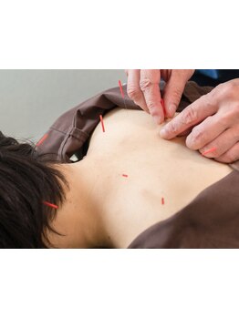 鍼灸施術を受けたい