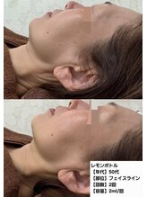 アオダモ(aodamo)/