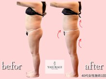 プライベートサロン やすらぎ/1回でお腹周りスッキリ！