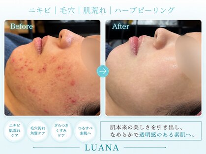 ルアナ 柏本店(LUANA)の写真