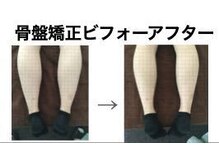 やち鍼灸院/骨盤を整えて腰痛予防に！