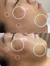 エユージュ(eyuge)/