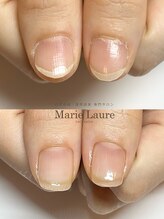 マリーロール 淀屋橋本店(Marie Laure)/自爪育成/深爪矯正/ネイルケア