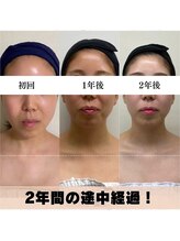 お顔の研究所/ビフォーアフター写真♪
