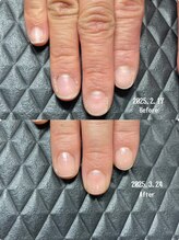 クーラ アンド ベリッシモ(Cura&Bellissimo)/自爪育成