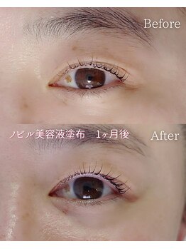 ウル(ulu)/NOBIRU美容液