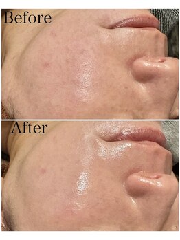 ブラックボックス(BLACK BOX)/40代女性のお客様