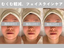 ミピマム 町田店/一回一回効果ちゃんと実感☆